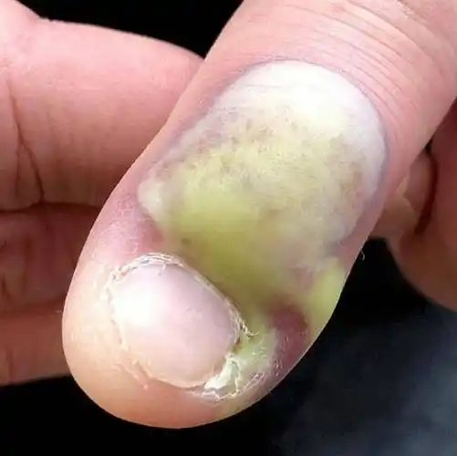 对于lauren来说,后几点很容易做到,但咬指甲这个习惯,一时半会还真改