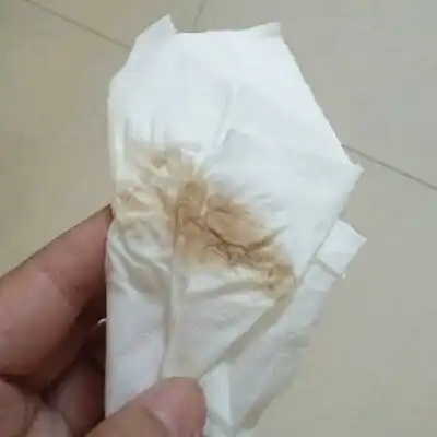 怀孕7周有黑褐色的东西怎麼回事? 好担心啊