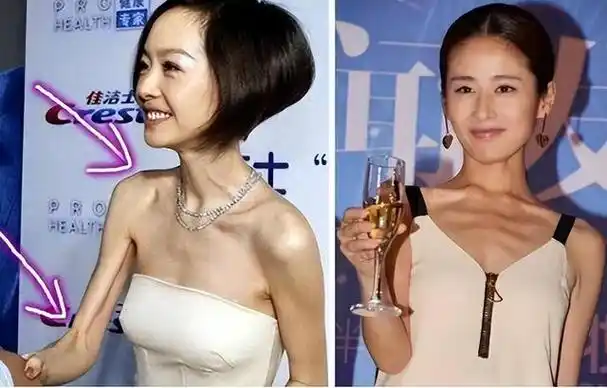 瘦到病态,强行装嫩,动脸整容,内娱的畸形审美,什么时候能结束|张檬