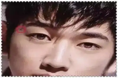 "财痣",哪里有痣能发财,快看看你有吗?