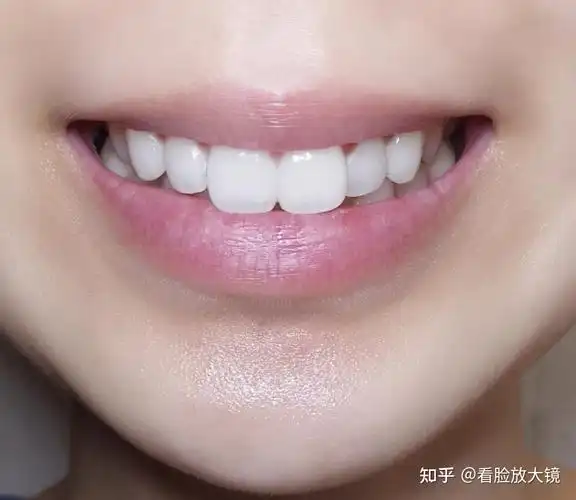 普通人日常如何科学的美白牙齿