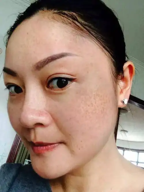 【女人必读】黑眼圈,面色发黄,皮肤干燥,长斑……你真的要好好看看这