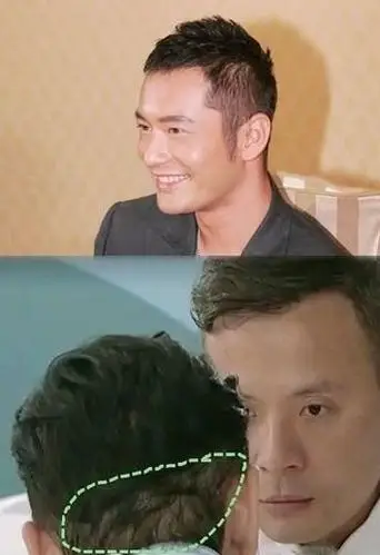 明星也爱植发,你可能不知道这三个明星