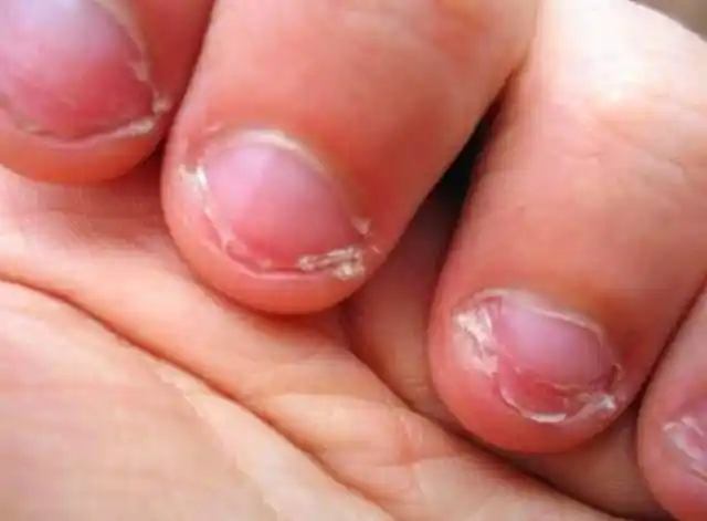 原创从小爱啃手指的孩子,长大难逃这3种结局,你家孩子中了吗?