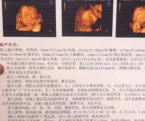 有很多孕妇在怀孕之后,由于体内激素发生明显的变化,会有妊娠反应