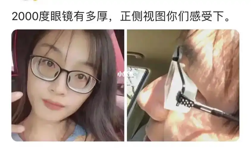 2000度近视的镜片