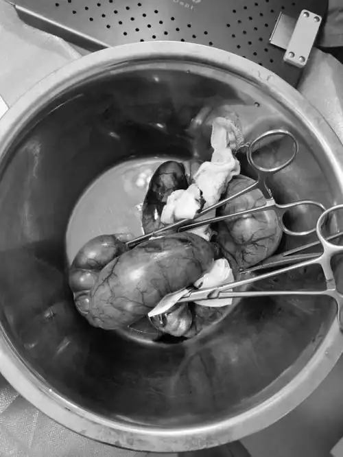 10斤的狗子蓄脓的子宫竟有2斤重