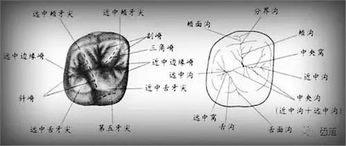 右上颌第一磨牙牙合面