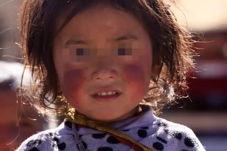 宝宝"红脸蛋"的罪魁祸首原来是它?再不注意,宝宝的脸就毁了