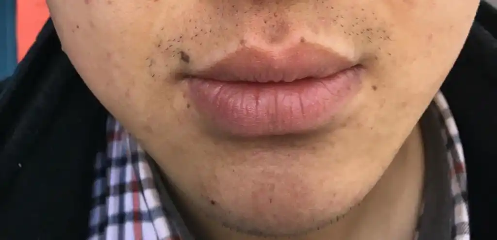 请问一下,这是吹火口吗,面相怎么样