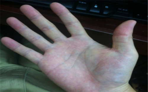 生命线很短却活到90岁也不是不可能