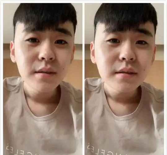 张云雷手术之后首晒照,又画眼线又p图,看到原片后粉丝难受了