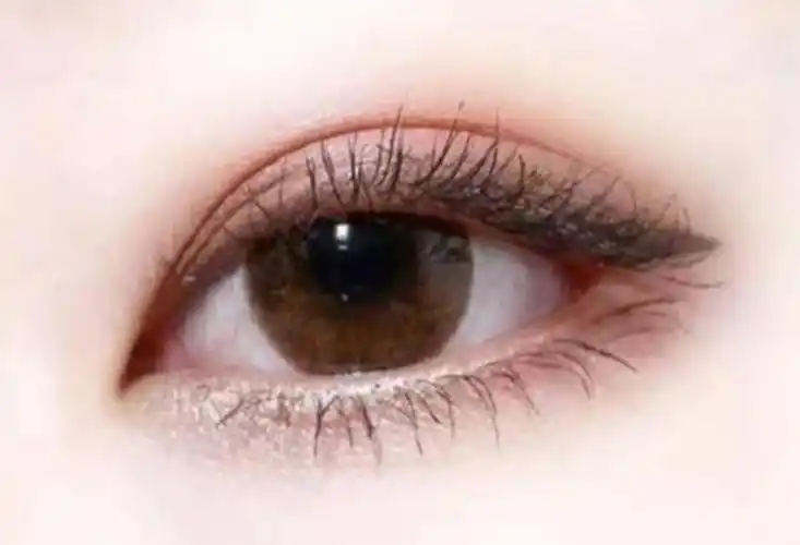 纹眼线1到7天图片差距怎么样个人真实手术经历记录眼睛变得有神