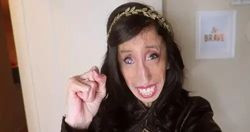 维拉斯克兹(lizzie velasquez)现年26岁,因患有马凡氏综合症(先天性中