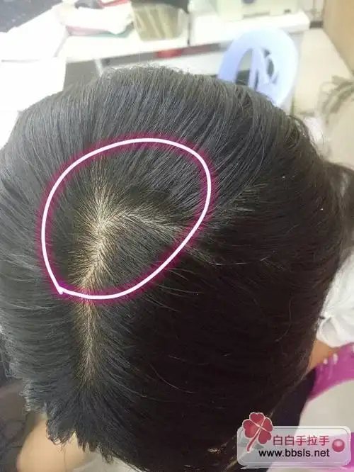 头皮就是这样正常吗?