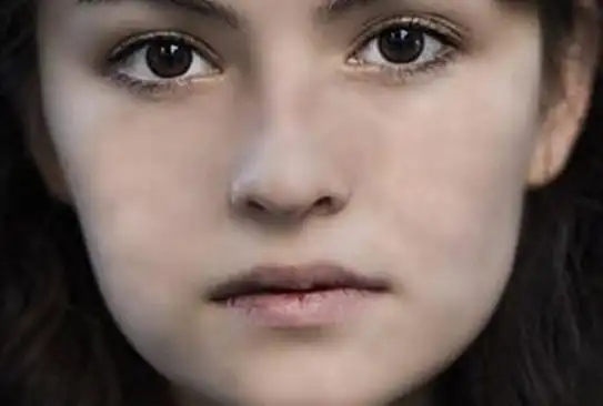 肤色不均的原因