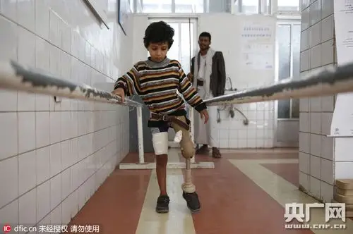 一名在也门战争中失去左腿的儿童在也门政府康复中心学习使用假肢行走