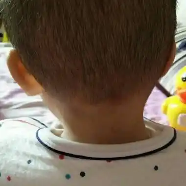 宝妈们,宝宝马上八个月了,脖子有点往左边偏,怎麼办啊?很担心!求帮助!