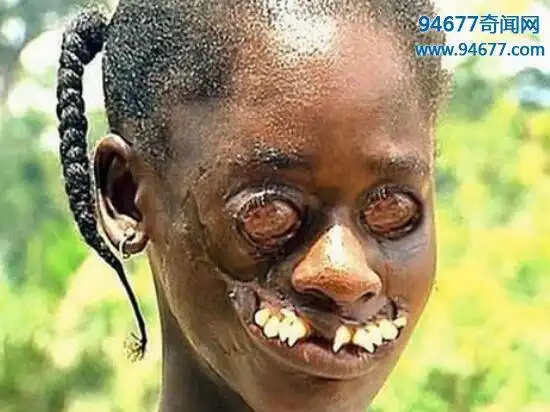 盘点世界上最丑的人丑到让人无法直视图片慎点