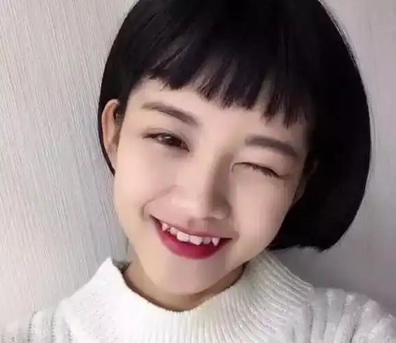 可爱的虎牙也不只是女生的特权▼一些明星也有健康又好看的虎牙▼一对