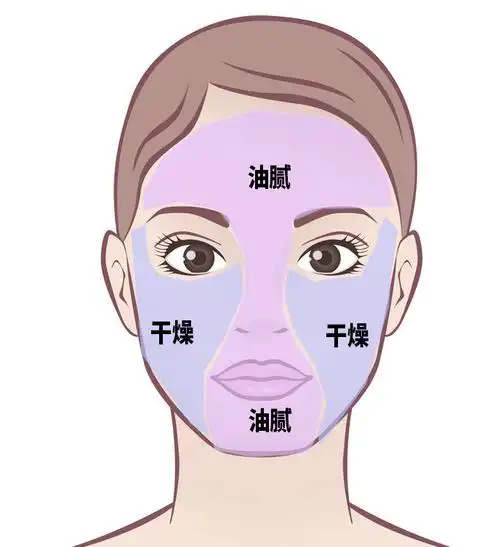 混合型肌肤到底是什么样呢,如下图所示:混合肌的日常护理重点因此,本