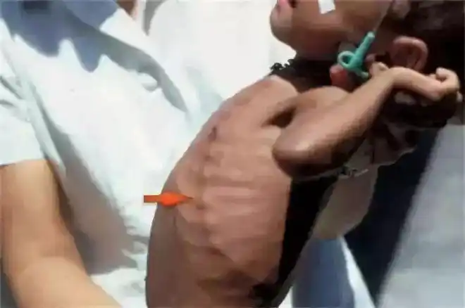 五彩斑斓! 鸡胸和正常人区别图片 "筑岩钓渭"-第1张图片-酷飞博客