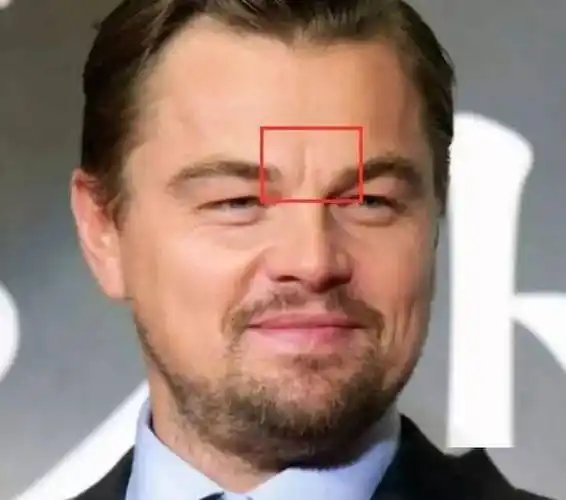 这些小习惯坚持做,皮肤越变越好_痘痘