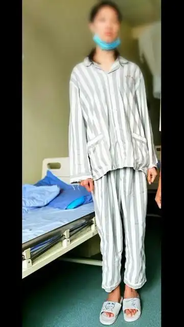 马凡综合征患者长睫毛身高175cm长手指矫正视力01行玻切人工晶体球壁