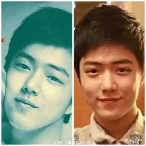 我看肖战肯定整容了吧,为什么大家都说他没整?