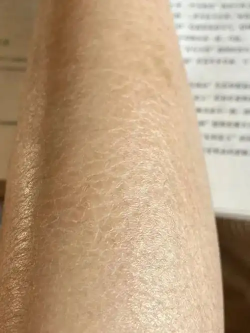 鱼鳞腿,是我冬天不敢轻易脱秋裤的原因|角质|肤质|身体乳|磨砂膏|皮肤