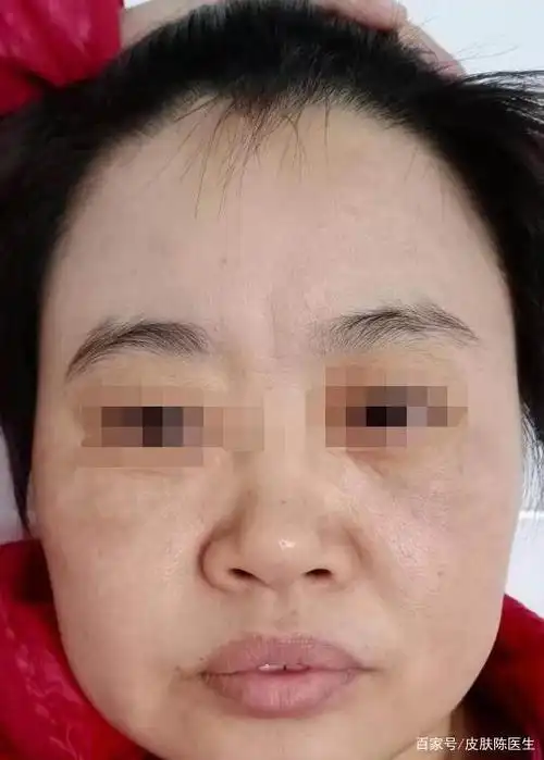 2:做好清洁卸妆,长期化妆的女性,脸部都存在暗沉,长斑,无光泽等问题 3