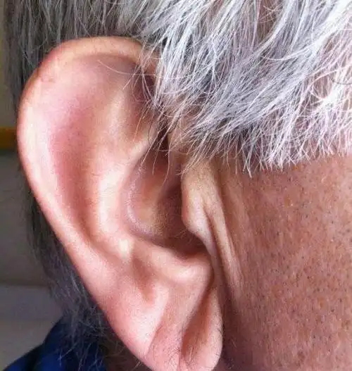 老人常说耳垂大的能长寿究竟有什么科学依据看完解开多年疑惑