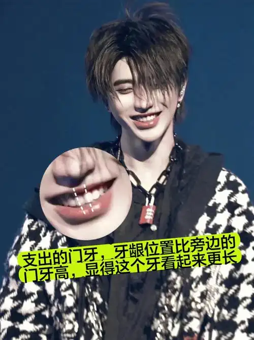 今天我来说一说蔡徐坤的牙齿,就你们的坤坤其实跟你们很多人都一样的