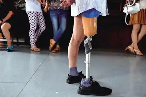 贵州小伙9岁右腿截肢博士期间在东京大学研发动力义肢并成立初创公司