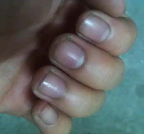 心脏病了从头到脚会有4种迹象2个以上不只要查心电图