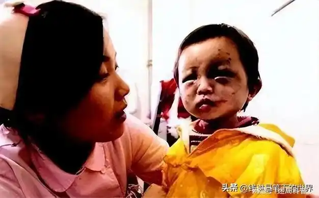 青海小苏丽3岁被针线缝嘴5岁被虐死7年后又遭生母掘坟