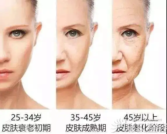 皮肤不同年龄段衰老程度展示图