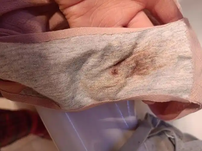 这样的排卵期带血正常吗?