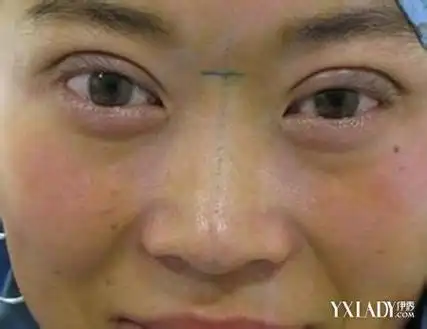 【图】塌鼻子面相 你需要知道这三种塌鼻