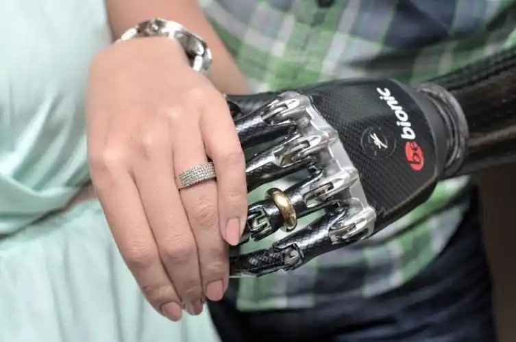 31岁的卢克-麦德兰德生下来就没有左手,只得安装假肢.