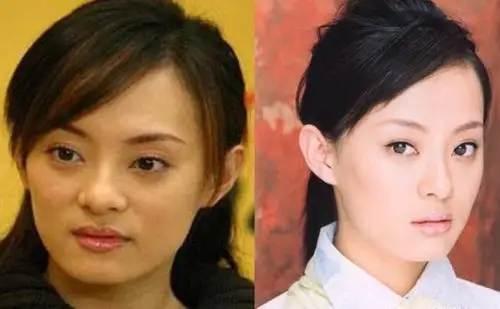 明星整容前后对比图3曾被骂无耻图4整残图7已消失