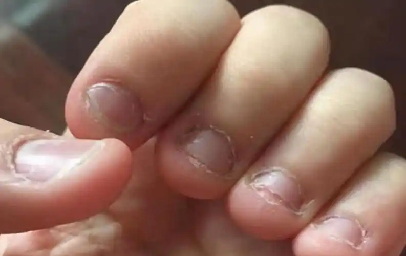 宝宝经常吃手,是因为饿了吗?三个好处不为人知,宝妈别急着制止