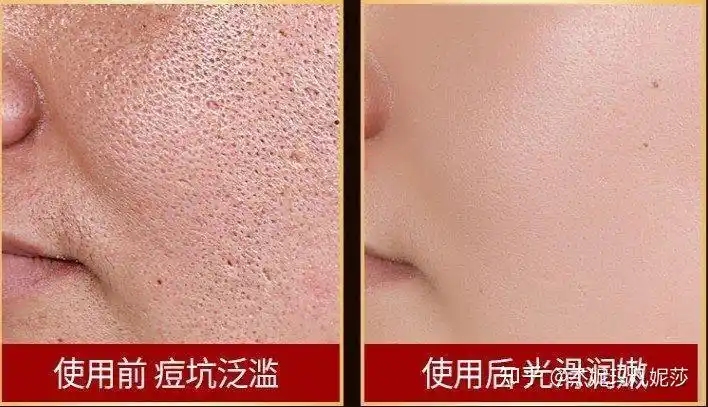 这就是p的~ 如果你眼神连p成这样都看不出来,也不需要处理毛孔粗大了