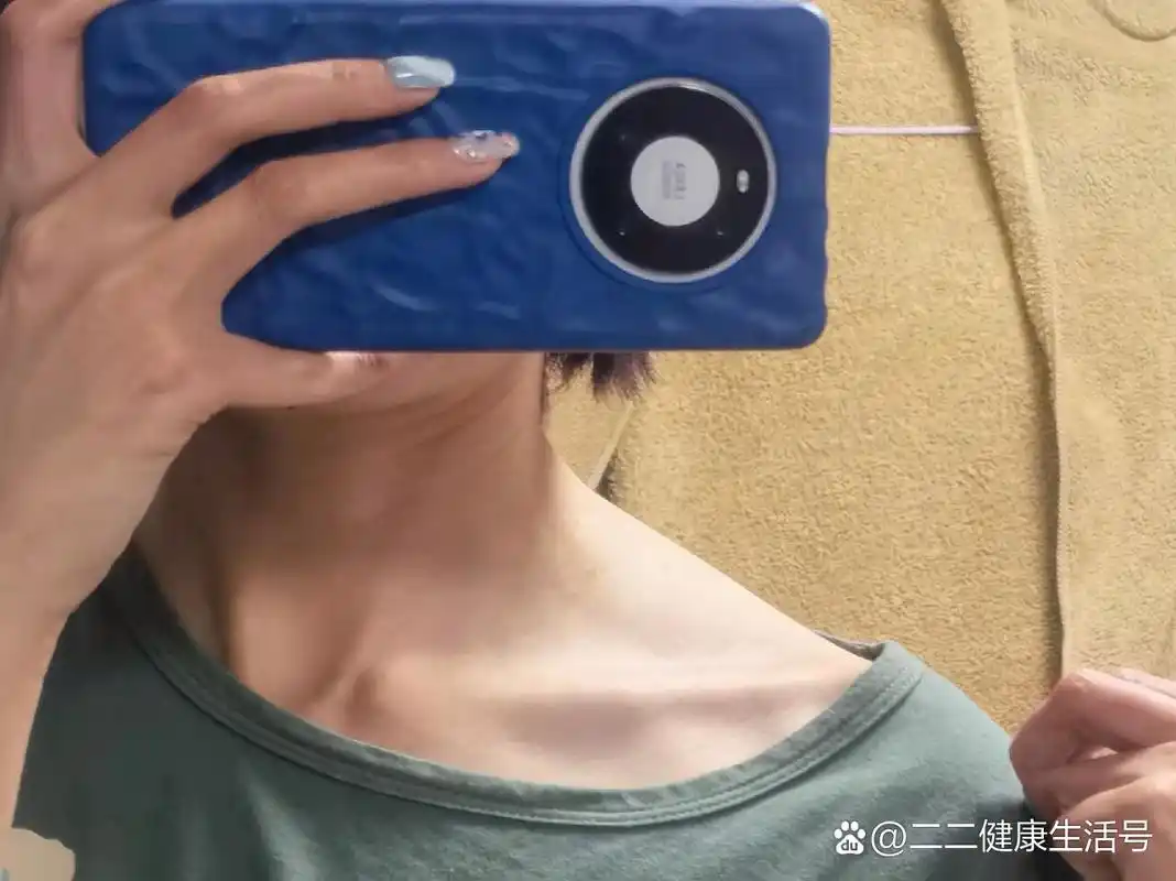 斜方肌求救 姐妹们,救救我 图一图二是左侧斜方肌,有一个超大鼓包,长