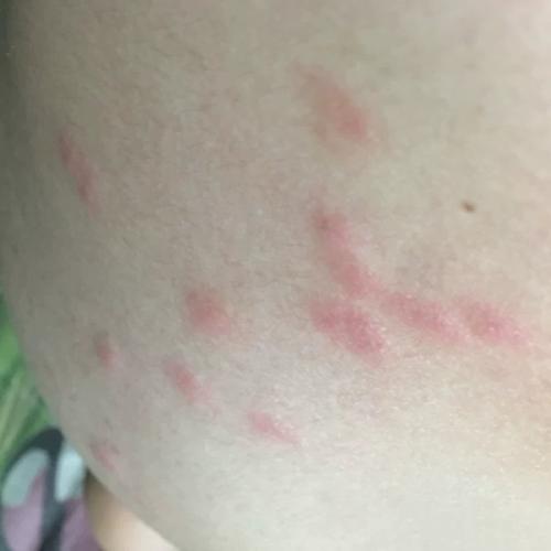 脚心痒牛癣皮1约快乐宝贝皮肤外用止痒药膏软膏  康支包邮