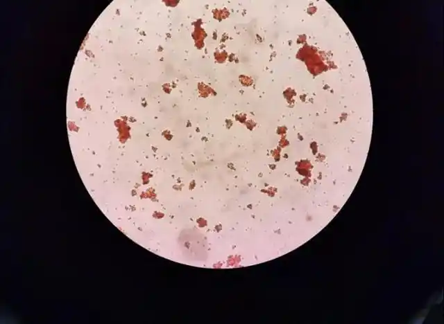 图1聚凝胺法主侧凝集按标准流程进行交叉配血,盐水介质法 聚凝胺法.