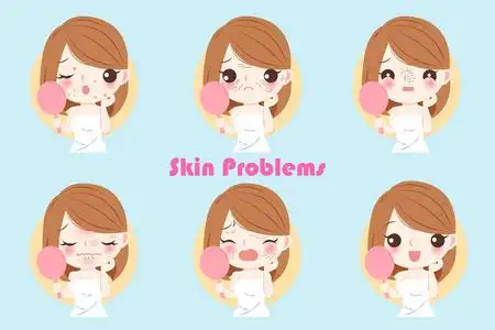 女性面部皮肤问题的白色背景美容卡通女性面部皮肤问题脸上皮肤问题