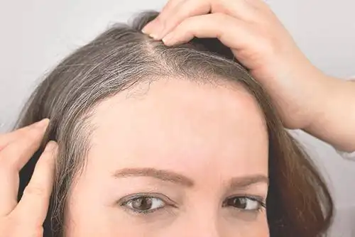 为何会长白头发?拔一根白发会长三根吗? - iwsd香港预约九价hpv疫苗官