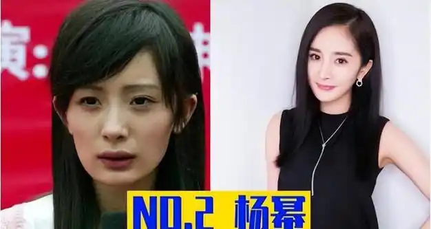 女明星整容前后对比照