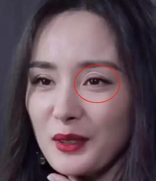 杨幂近照显老态,眼睛上方有奇怪褶皱,莫非是整形后遗症?